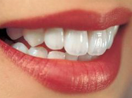 <b>什么是牙齿美白？</b>