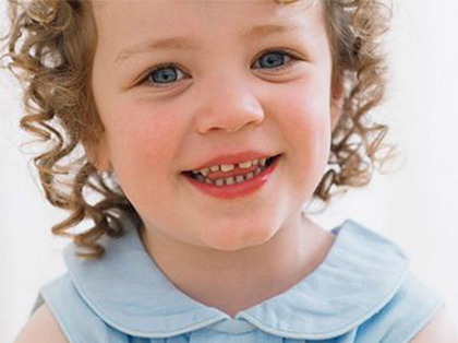 牙釉质发育不全怎么治疗？