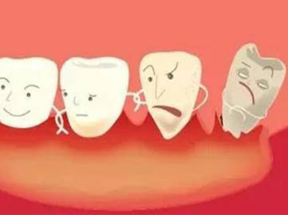 <b>慢性牙周炎如何治疗</b>