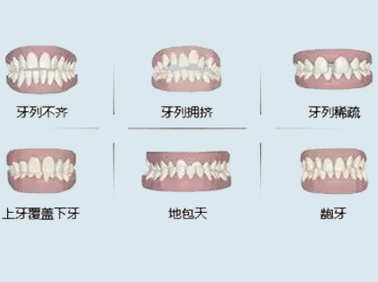 <b>什么情况下需要做牙齿矫正？</b>