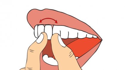 <b>牙外伤牙齿松动如何处理？</b>